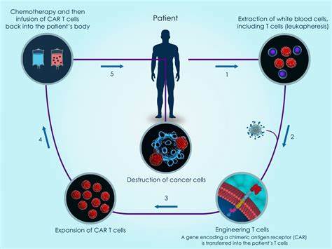 Tecnologia Experimental CAR-T Cell no SUS Brasileiro: Um Novo Horizonte na Luta Contra o Câncer
